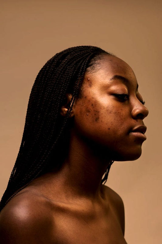 Young Black woman with natural skin texture and hyperpigmentation, eyes closed, serene expression, warm studio light